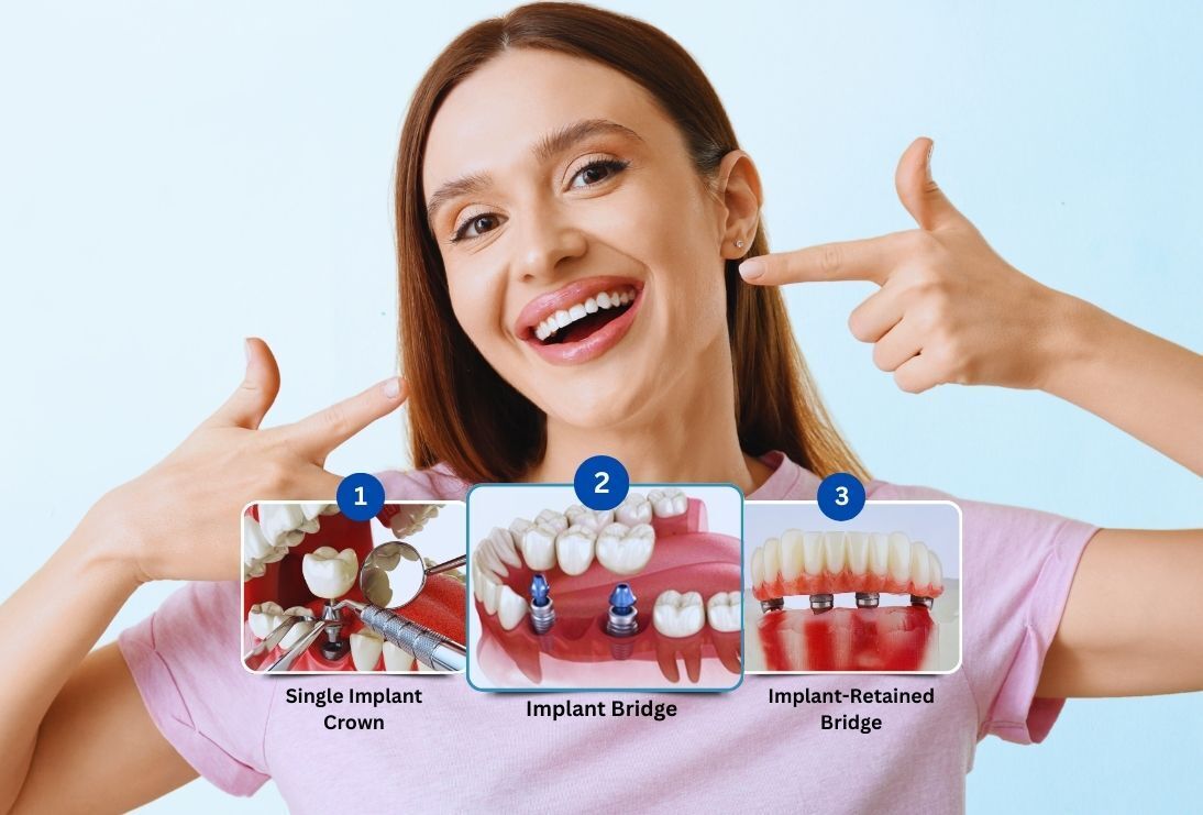 Cover image for Are Dental Implants Right for You?